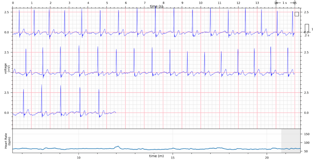 Fitness ECG shows V2 and V3 data from a Polar H10 heart rate strap